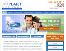 Tablet Screenshot of implantcenters.com